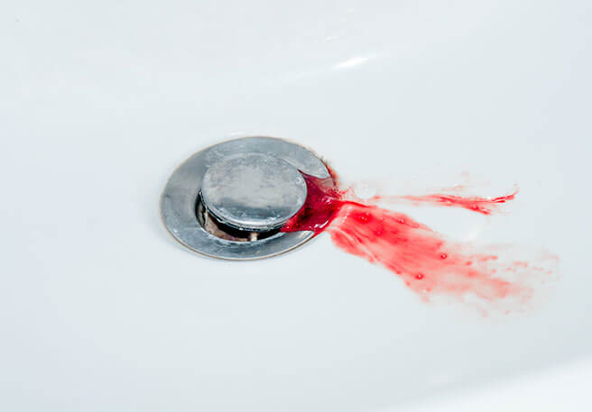  Zahnfleischbluten kann verschiedene Ursachen haben 