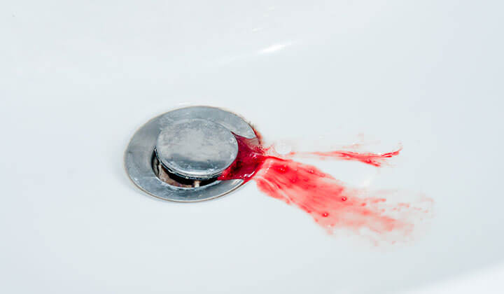 Zahnfleischbluten kann verschiedene Ursachen haben 