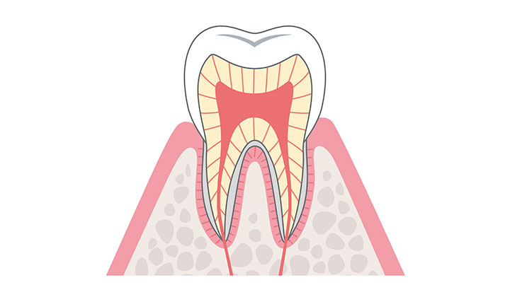 Zahn und Zahnfleisch     