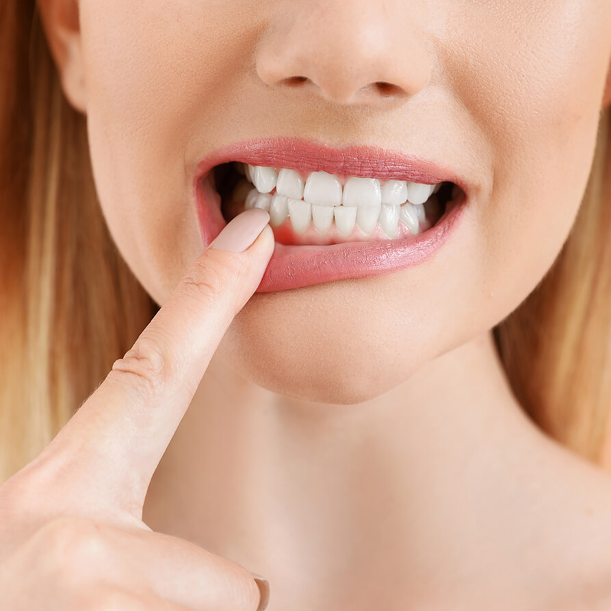 Frau prüft Zahnfleisch       