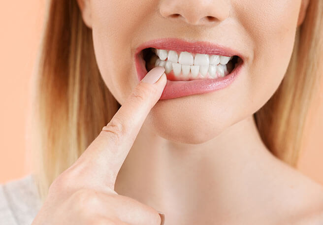 Frau prüft Zahnfleisch  